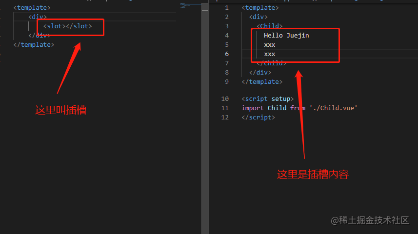 Vue3插槽(slot)的使用方法全解